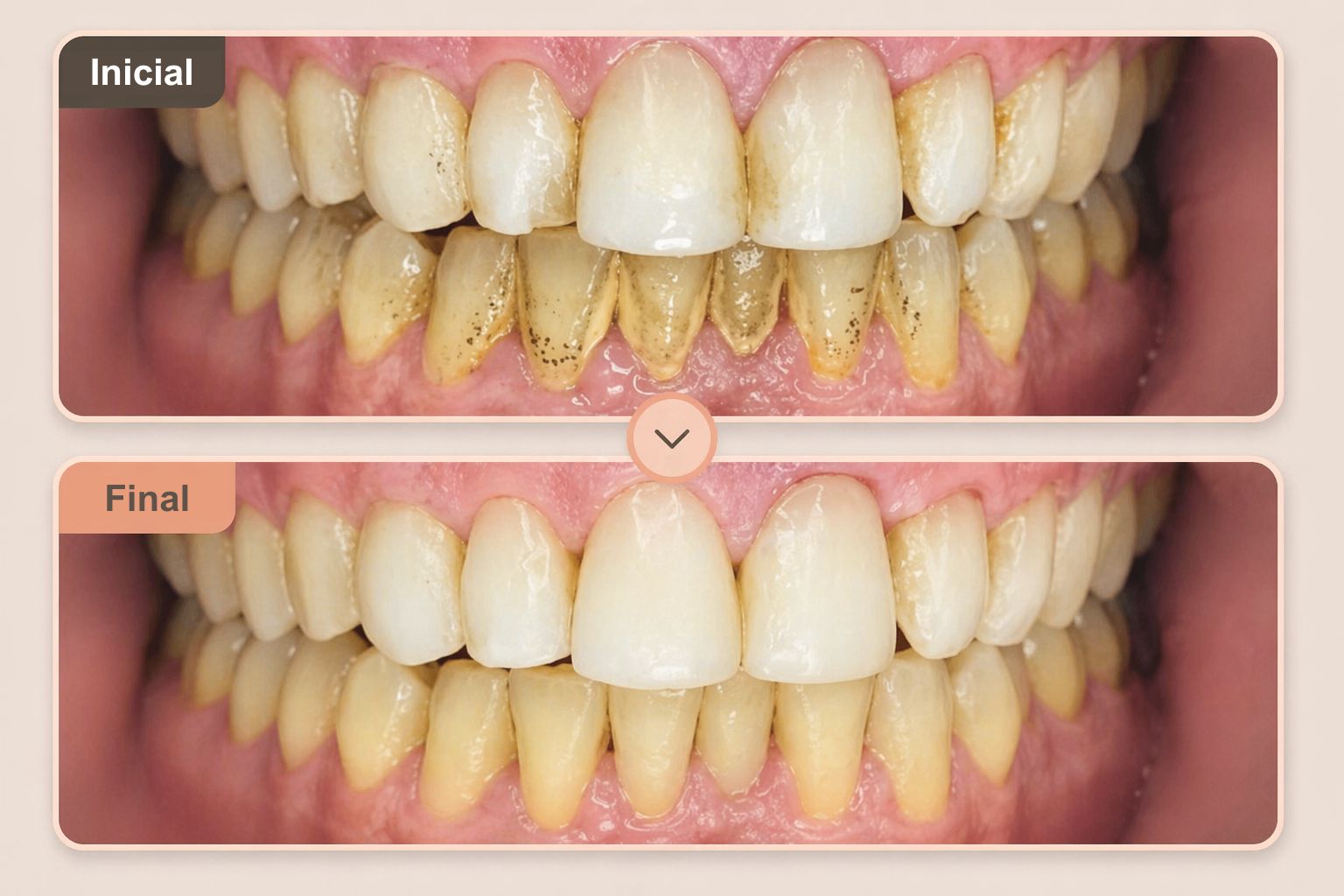 Antes e Depois Limpeza Profissional