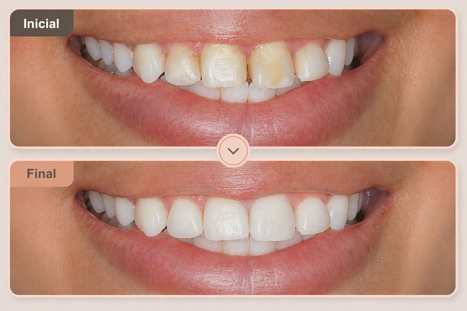 Antes e Depois Restauração